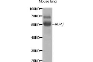 Western Blotting (WB) image for anti-Recombination Signal Binding Protein For Immunoglobulin kappa J Region (RBPJ) antibody (ABIN1876876) (RBPJ anticorps)