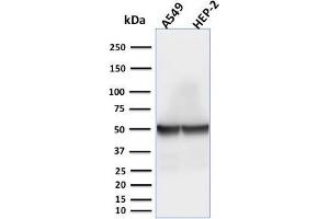 Western Blot Analysis of A549 and HEP-2 cell lysates using Cytokeratin 18 Mouse Monoclonal Antibody (rKRT18/1190).
