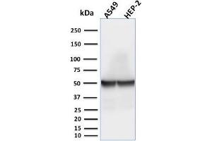Western Blot Analysis of A549 and HEP-2 cell lysates using Cytokeratin 18 Mouse Monoclonal Antibody (rKRT18/1190). (Recombinant Cytokeratin 18 anticorps)