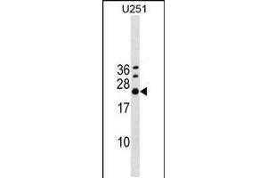 Western blot analysis in U251 cell line lysates (35ug/lane). (EXOSC4 anticorps  (AA 69-96))
