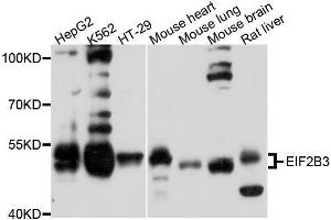 Western blot analysis of extracts of various cell lines, using EIF2B3 antibody. (EIF2B3 anticorps  (AA 1-270))