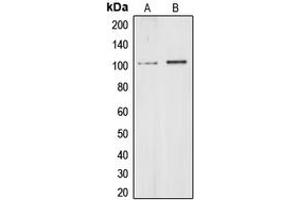 Western blot analysis of CHD1L expression in HeLa (A), HEK293T (B) whole cell lysates. (CHD1L anticorps  (Center))