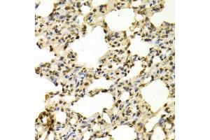 Immunohistochemistry (IHC) image for anti-Peptidyl Arginine Deiminase, Type IV (PADI4) (AA 1-250) antibody (ABIN1681212)