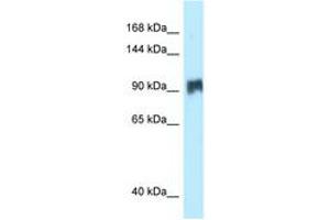 Image no. 1 for anti-Salt-Inducible Kinase 2 (SIK2) (AA 281-330) antibody (ABIN6747898) (SIK2 anticorps  (AA 281-330))