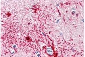 Anti-FABP7 / BLBP antibody IHC staining of human brain, cortex.