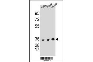 TYSY Antibody (C-term) A western blot analysis in Hela,Jurkat and HL-60 cell line lysates (35 μg/lane). (TYMS anticorps  (C-Term))