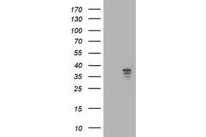 Western Blotting (WB) image for anti-Nudix (Nucleoside Diphosphate Linked Moiety X)-Type Motif 9 (NUDT9) antibody (ABIN1499874) (NUDT9 anticorps)