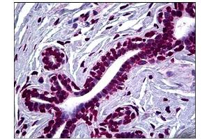 Immunohistochemistry (IHC) image for anti-SMAD, Mothers Against DPP Homolog 2 (SMAD2) antibody (ABIN781909)