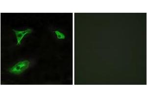 Immunofluorescence analysis of HeLa cells, using GPR116 Antibody. (G Protein-Coupled Receptor 116 anticorps  (AA 11-60))