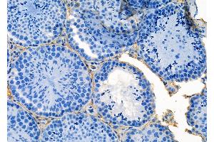 ABIN6264958 and ABIN6273159 at 1/100 staining Mouse testis tissue by IHC-P. (SEC24A anticorps  (Internal Region))