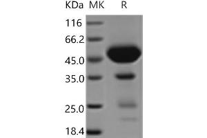 Western Blotting (WB) image for C-Type Lectin Domain Family 2, Member D (CLEC2D) protein (Fc Tag) (ABIN7321164) (CLEC2D Protein (Fc Tag))