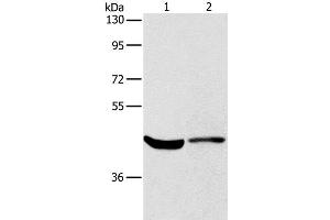Western Blot analysis of Hela cell and Mouse kidney tissue using KCNA7 Polyclonal Antibody at dilution of 1:550