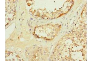 Immunohistochemistry of paraffin-embedded human testis tissue using ABIN7159917 at dilution of 1:100 (TOMM34 anticorps  (AA 1-309))