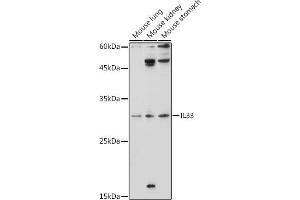 Western blot analysis of extracts of various cell lines, using IL33 antibody (ABIN6128136, ABIN6142383, ABIN6142385 and ABIN6224121) at 1:1000 dilution.