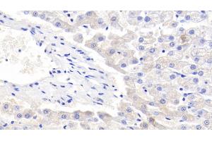 Detection of LTF in Canine Liver Tissue using Polyclonal Antibody to Lactoferrin (LTF) (Lactoferrin anticorps  (AA 28-351))