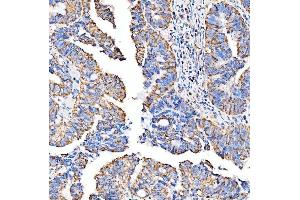 IHC analysis of SUCLG2 using anti-SUCLG2 antibody (ABIN7601694). (SUCLG2 anticorps  (AA 42-424))