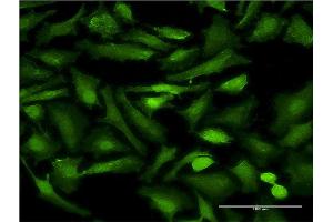 Immunofluorescence of monoclonal antibody to EHD2 on HeLa cell.