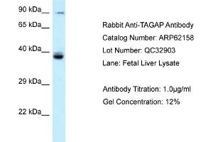 Western Blotting (WB) image for anti-T-Cell Activation rho GTPase-Activating Protein (TAGAP) (N-Term) antibody (ABIN2789039) (TAGAP anticorps  (N-Term))