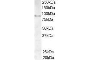 Western Blotting (WB) image for anti-A Kinase (PRKA) Anchor Protein 3 (AKAP3) (C-Term) antibody (ABIN2465380) (AKAP3 anticorps  (C-Term))