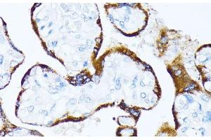 Immunohistochemistry of paraffin-embedded Human placenta using CSNK1A1 Polyclonal Antibody at dilution of 1:100 (40x lens). (CSNK1A1 anticorps)