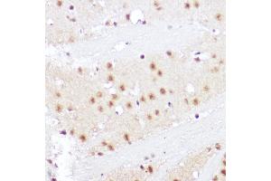 Immunohistochemistry of paraffin-embedded rat brain using SMOX Rabbit pAb (ABIN6132875, ABIN6148142, ABIN6148143 and ABIN6215369) at dilution of 1:100 (40x lens). (SMOX anticorps  (AA 1-200))