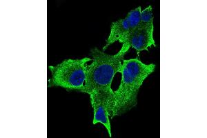 Immunofluorescence analysis of HepG2 cells using RPTOR mouse mAb (green).
