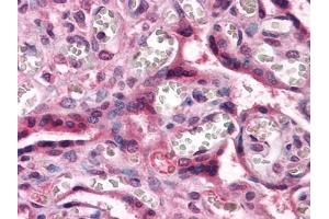 Immunohistochemical analysis of paraffin-embedded human Placenta tissues using CTNNB1 antibody (CTNNB1 anticorps)