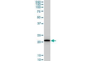 RPS5 monoclonal antibody (M02), clone 4H3.