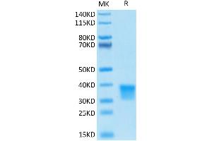 Human OSM on Tris-Bis PAGE under reduced conditions.