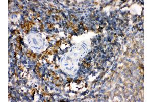 Anti- TGM2 Picoband antibody, IHC(P) IHC(P): Rat Spleen Tissue (Transglutaminase 2 anticorps  (N-Term))