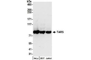 Western Blotting (WB) image for anti-threonyl-tRNA Synthetase (TARS) (AA 1-50) antibody (ABIN7450801)