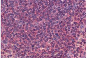 Human Spleen: Formalin-Fixed, Paraffin-Embedded (FFPE)