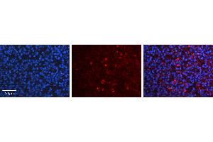 Rabbit Anti-USF1 Antibody   Formalin Fixed Paraffin Embedded Tissue: Human Lymph Node Tissue Observed Staining: Nucleus Primary Antibody Concentration: 1:100 Other Working Concentrations: N/A Secondary Antibody: Donkey anti-Rabbit-Cy3 Secondary Antibody Concentration: 1:200 Magnification: 20X Exposure Time: 0.