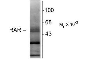 Western Blotting (WB) image for anti-Retinoic Acid Receptor, beta (RARB) (N-Term) antibody (ABIN371838) (Retinoic Acid Receptor beta anticorps  (N-Term))