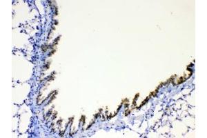 IHC testing of FFPE mouse lung tissue with AGRP antibody at 1ug/ml. (AGRP anticorps)