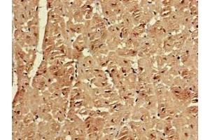 Immunohistochemistry of paraffin-embedded human heart tissue using ABIN7151606 at dilution of 1:100