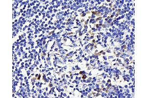 Immunohistochemistry analysis of paraffin-embedded human tonsil using CD169 Polyclonal Antibody at dilution of 1:300. (Sialoadhesin/CD169 anticorps)