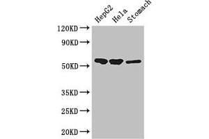 Western Blot Positive WB detected in: HepG2 whole cell lysate, Hela whole cell lysate, Mouse stomach tissue All lanes: SLC37A2 antibody at 3 μg/mL Secondary Goat polyclonal to rabbit IgG at 1/50000 dilution Predicted band size: 55, 43, 14 kDa Observed band size: 55 kDa
