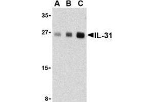 Western blot analysis of IL-31 in human skeletal muscle tissue lysate with AP30423PU-N IL-31 antibody at (A) 2.