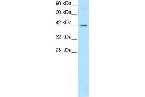 WB Suggested Anti-FOSL2 Antibody Titration: 0.