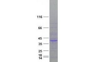 Validation with Western Blot