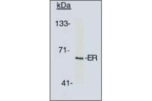 Image no. 1 for anti-Estrogen Receptor 1 (ESR1) antibody (ABIN201714) (Estrogen Receptor alpha anticorps)