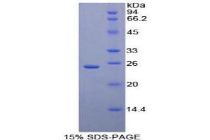 SDS-PAGE analysis of Human Iga Protein. (CD79a Protéine)