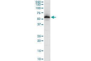 ZNF622 polyclonal antibody (A01), Lot # 060717JCS1. (ZNF622 anticorps  (AA 1-100))