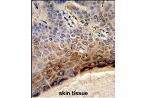 Formalin-fixed and paraffin-embedded human skin tissue reacted with CTHRC1 Antibody (N-term), which was peroxidase-conjugated to the secondary antibody, followed by DAB staining. (CTHRC1 anticorps  (N-Term))