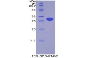 SDS-PAGE analysis of Human ADAM20 Protein.