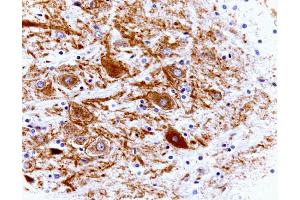 Rat cerebellum, zinc-fixed paraffin embedded tissue (left), 40X (Clathrin anticorps  (AA 4-171))