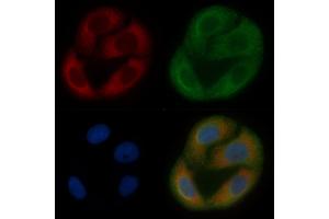 ALDH3B2 Mouse Monoclonal Antibody staining Hela cells by IF/ICC. (ALDH3B2 anticorps  (C-Term))