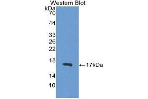 Western Blotting (WB) image for anti-Synuclein, gamma (Breast Cancer-Specific Protein 1) (SNCG) (AA 1-123) antibody (ABIN1078561) (SNCG anticorps  (AA 1-123))