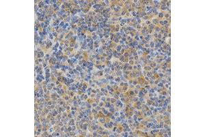 Immunohistochemistry (IHC) image for anti-Protein Kinase C, epsilon (PRKCE) (AA 488-737) antibody (ABIN3022942)